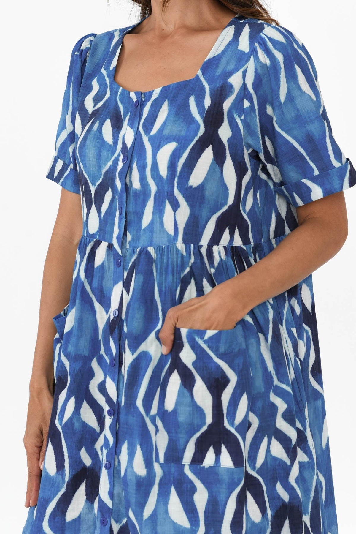 Rory Blue Abstract Cotton Button Dress Detail View